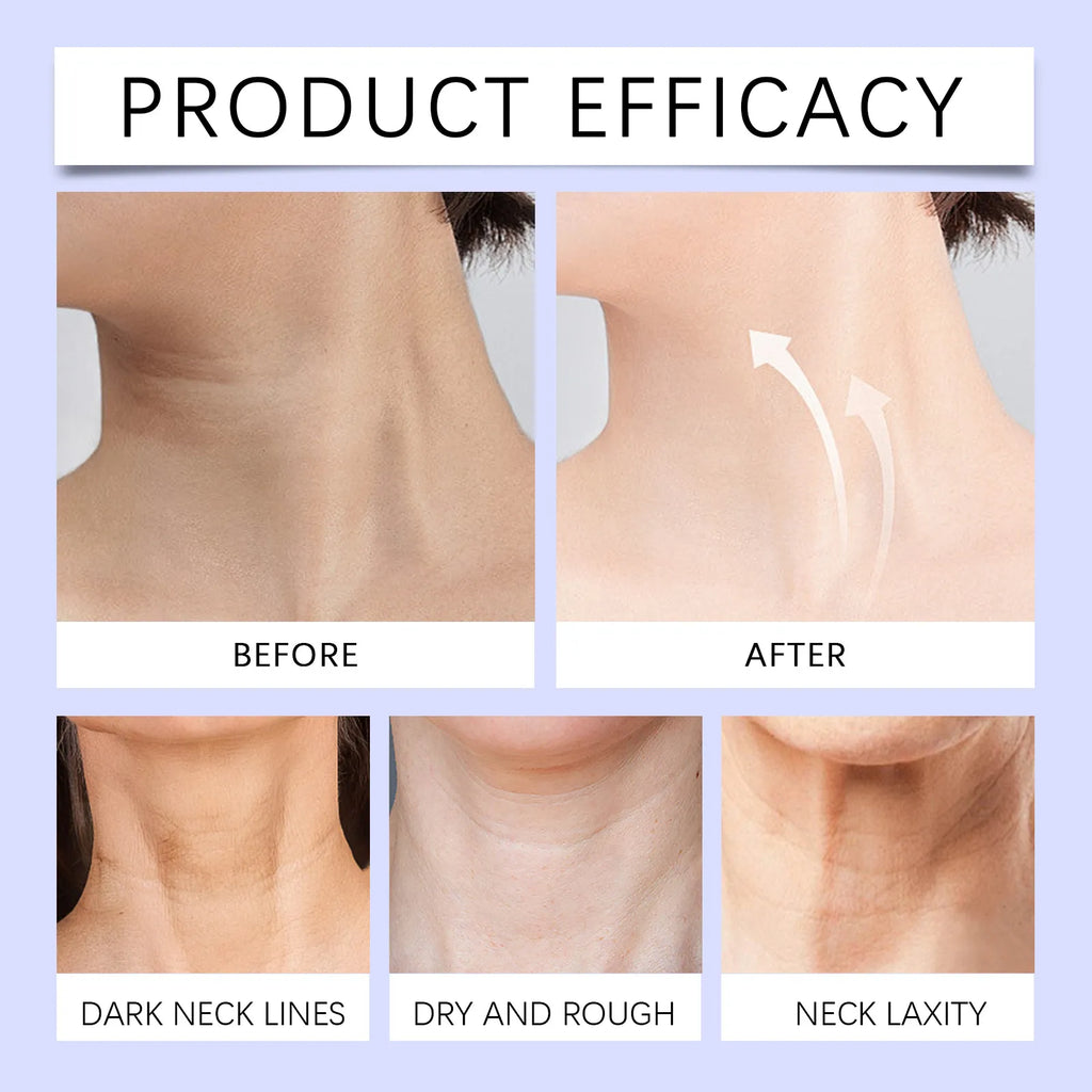 Anti-Aging Neck Cream